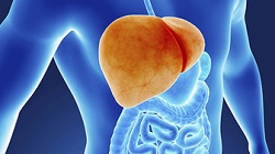 شرایط پیوند کبد در مبتلایان به سیروز کبدی 